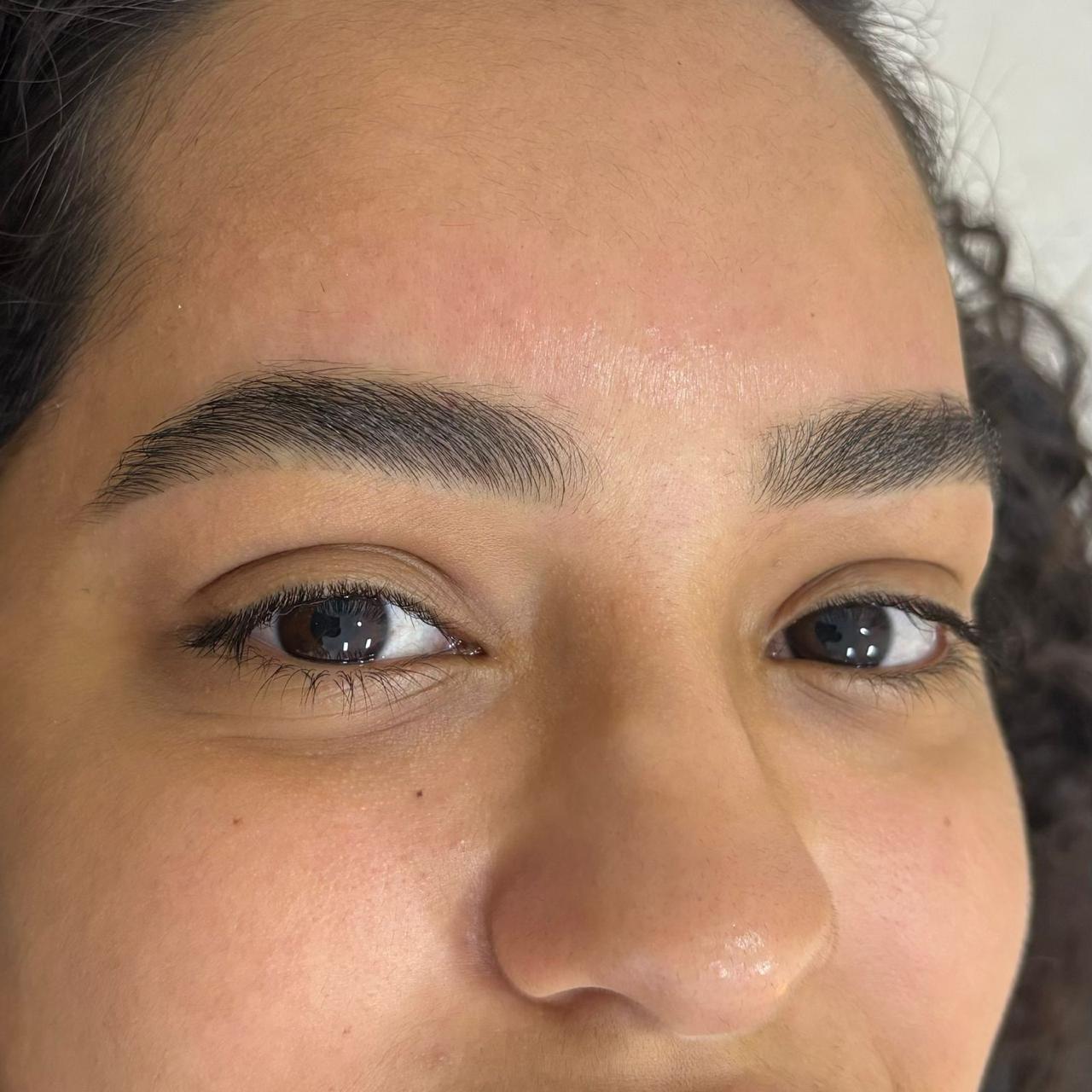 Foto do procedimento de Design personalizado em uma cliente