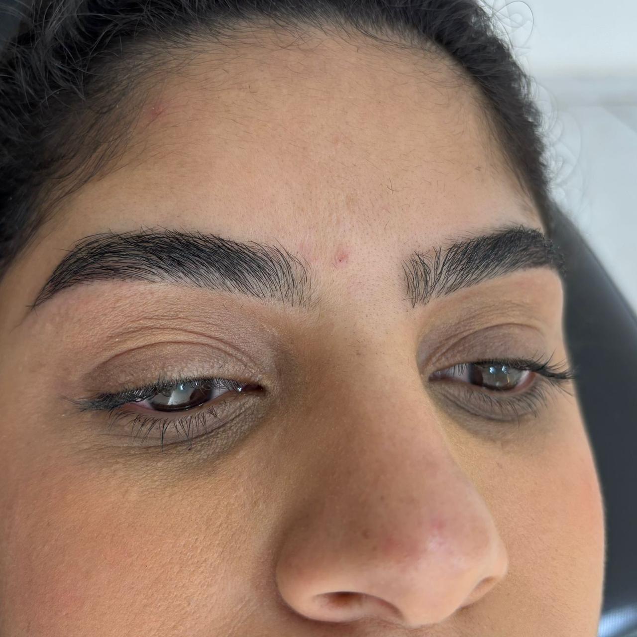 Foto do procedimento de Design personalizado em uma cliente