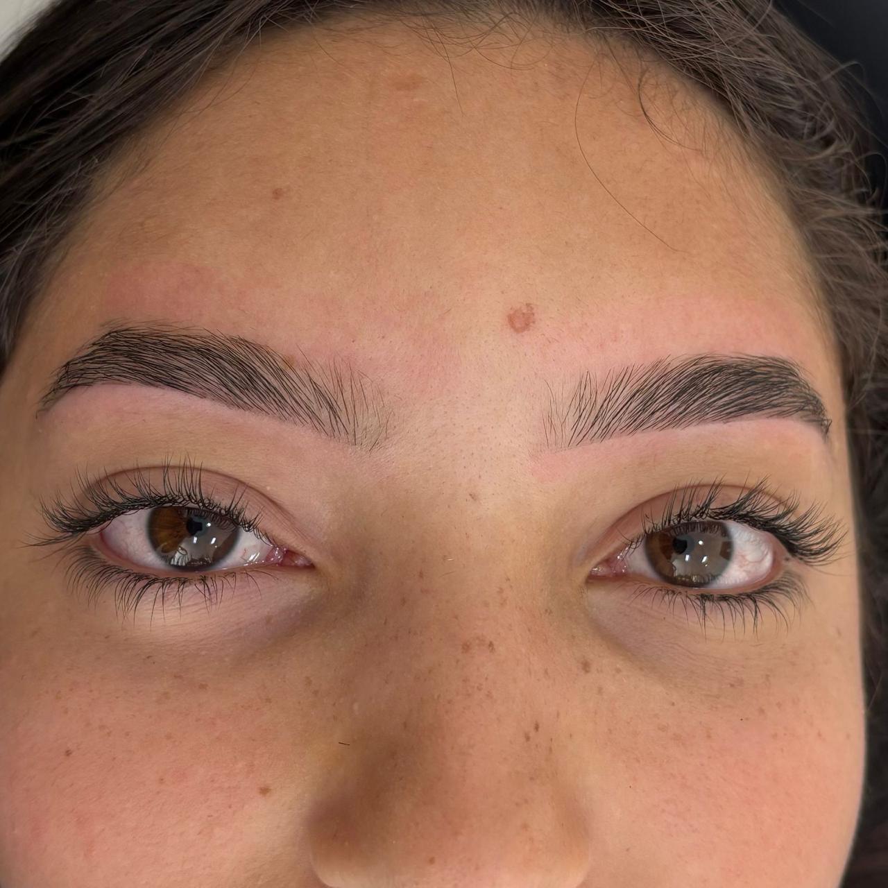 Foto do procedimento de Design personalizado em uma cliente