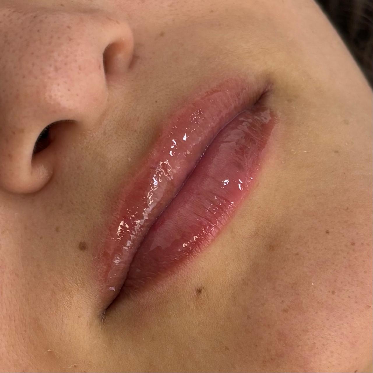 Foto do procedimento de Nutrigloss