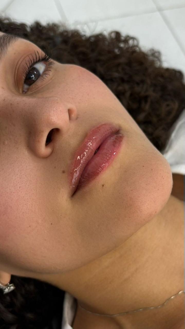Foto do procedimento de Nutrigloss